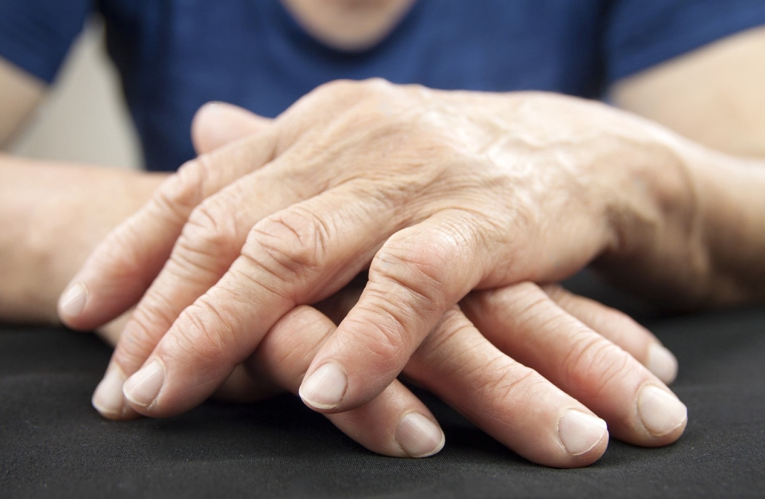 Causes And Risk Factors Of Rheumatoid Arthritis